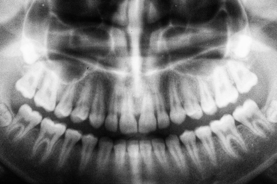 dental-xray