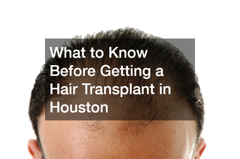 What to Know Before Getting a Hair Transplant in Houston